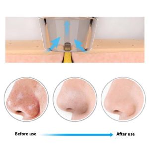 Facial Blackhead Remover Pore Cleaner Vacuum Peeling Dead Skin Acne remover Device Cleaning Tool Blackhead Sucking Machine Gift - MAQHUB