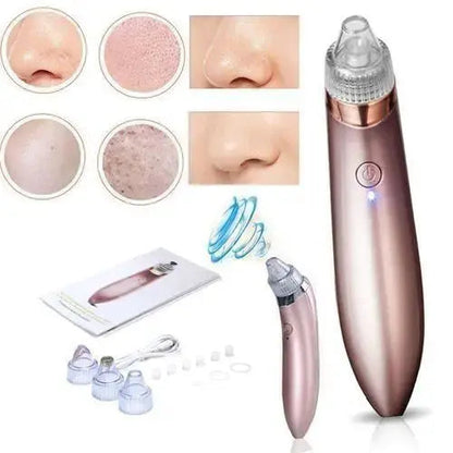 Blackhead Remover Face Acne Black Dot Pimple Electric Black head Vacuum Cleaner Pore Skin Care Tools Machine 4 Replacement Head - MAQHUB