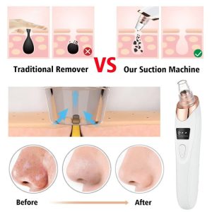 Facial Blackhead Remover Pore Cleaner Vacuum Peeling Dead Skin Acne remover Device Cleaning Tool Blackhead Sucking Machine Gift - MAQHUB