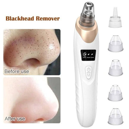 Facial Blackhead Remover Pore Cleaner Vacuum Peeling Dead Skin Acne remover Device Cleaning Tool Blackhead Sucking Machine Gift - MAQHUB