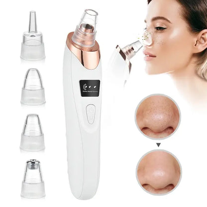 Facial Blackhead Remover Pore Cleaner Vacuum Peeling Dead Skin Acne remover Device Cleaning Tool Blackhead Sucking Machine Gift - MAQHUB